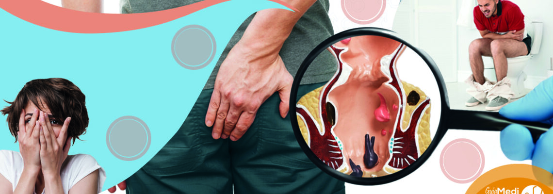 Hemorroides, ¡Como molestan!
