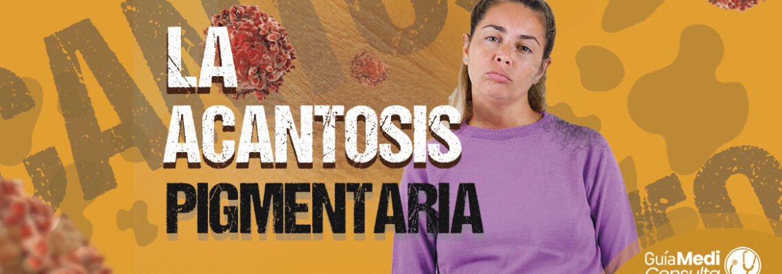 Acantosis Pigmentaria