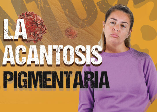 Acantosis Pigmentaria