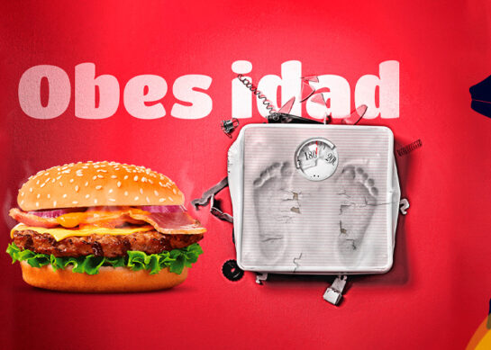 Obesidad